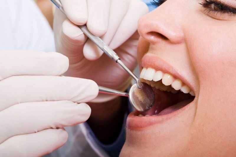 Important Things to Know Before Getting a Root Canal